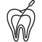 Salvar tu diente es nuestra prioridad. La endodoncia es la mejor opción para eliminar infecciones sin necesidad de extraer la pieza dental. Gracias a nuestra tecnología de precisión, el tratamiento es rápido, seguro y prácticamente indoloro. ¡Recupera la salud de tu sonrisa sin miedo al dolor!